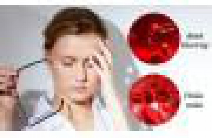 6 dấu hiệu 'lạ' khi thiếu sắt và 15 loại thực phẩm bổ sung sắt hiệu quả 