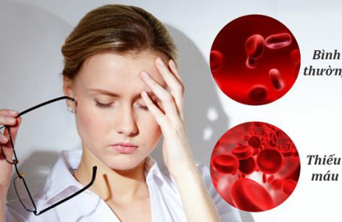 Dấu hiệu và cách bổ sung sắt qua thực phẩm